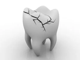 Dentist Richardson TX (3)