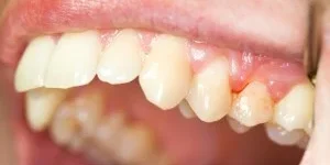 Dentist in Richardson (4)
