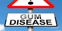 Dentist in Richardson TX (3)