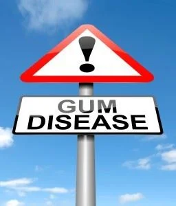 Dentist in Richardson TX (3)