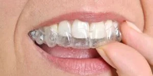 Dr.James S. Guirguis DDS (2)