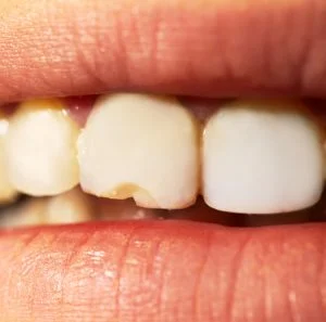 Dr.Michael Guirguis DDS (1)