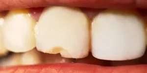 Dr.Michael Guirguis DDS (1)