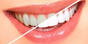 Richardson Dentist (2)