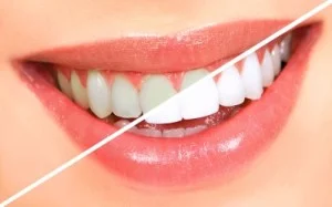 Richardson Dentist (2)
