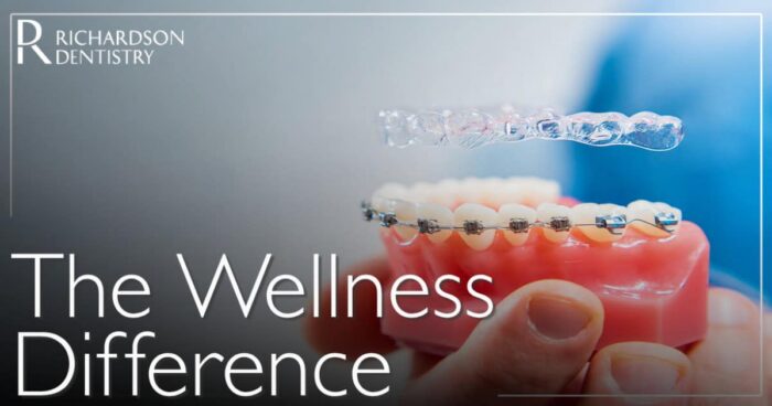 Invisalign vs. Braces