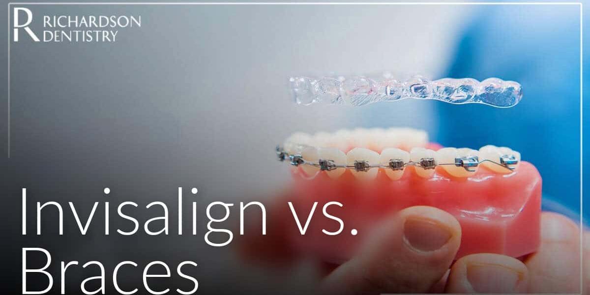 v2_Invisalign-vs.-Braces-Which-Teeth-Straightening-Option-Is-Right-for-You