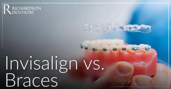 v2_Invisalign-vs.-Braces-Which-Teeth-Straightening-Option-Is-Right-for-You