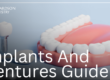 Dental Implants vs Dentures