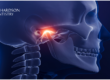 How to Cure TMJ Permanently