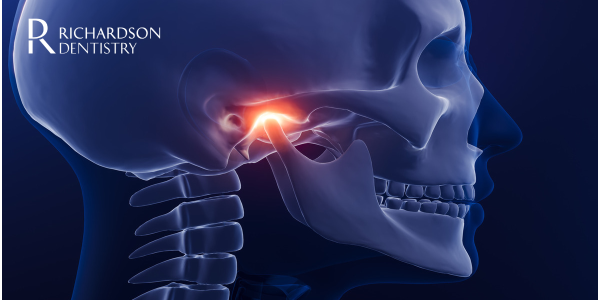 How to Cure TMJ Permanently 1 How to Cure TMJ Permanently