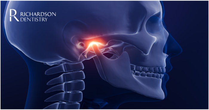 How to Cure TMJ Permanently 1 How to Cure TMJ Permanently